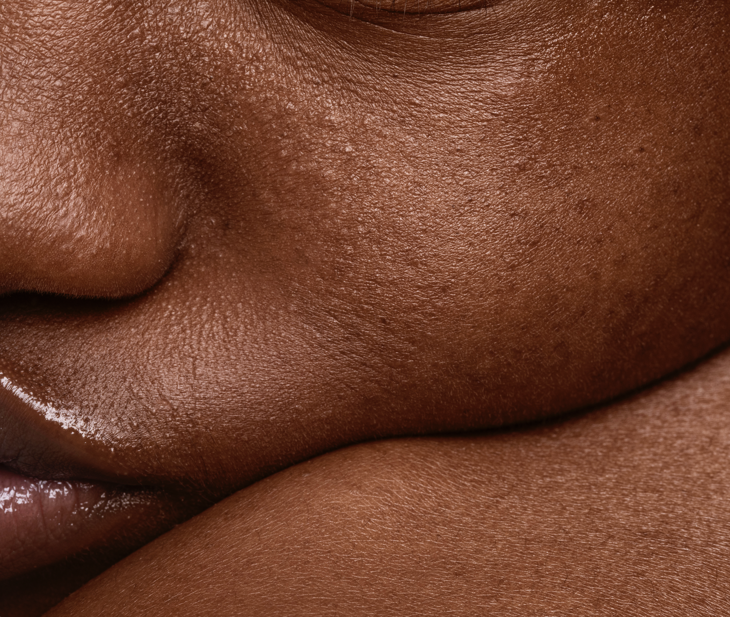 DULL, TIRED & LACKLUSTRE SKIN