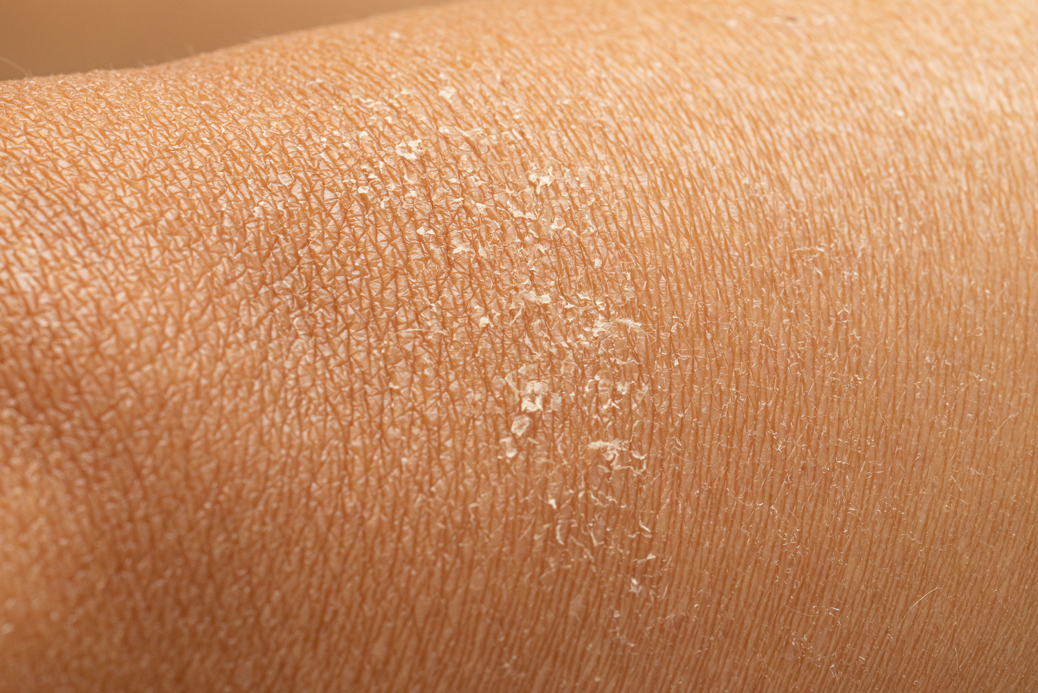 HYDRATION & DRY SKIN